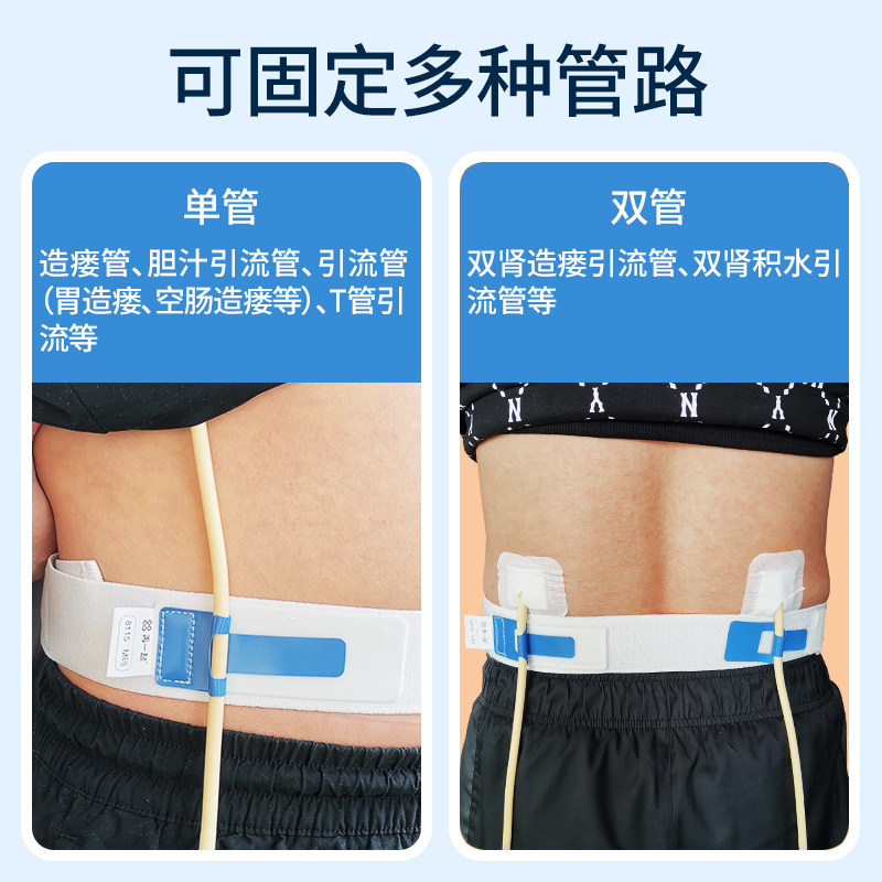 胃造瘘导管固定腰带 双肾造瘘双管固定腰带腰部腹腔胆汁T管引流管