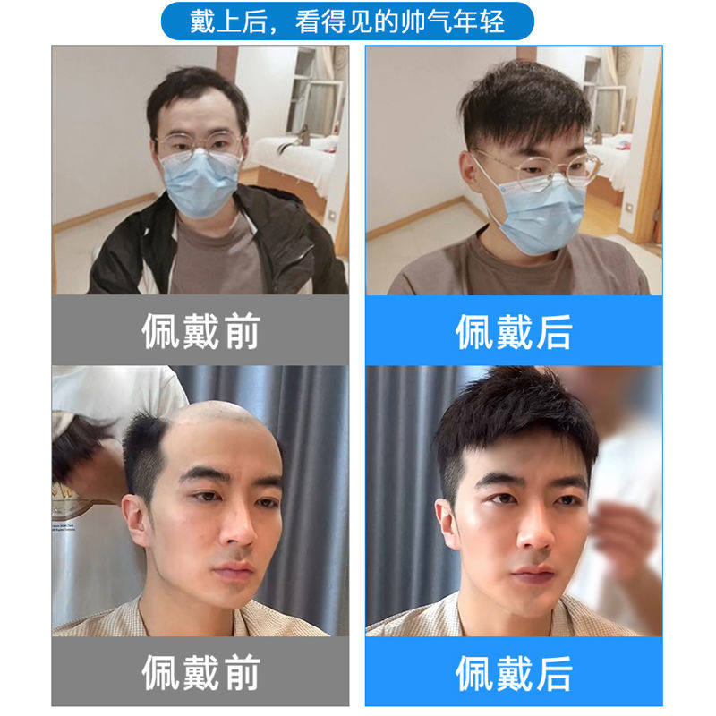 假发男短发毛寸全真发无痕隐形假发片男士可粘可卡轻薄头顶补发片