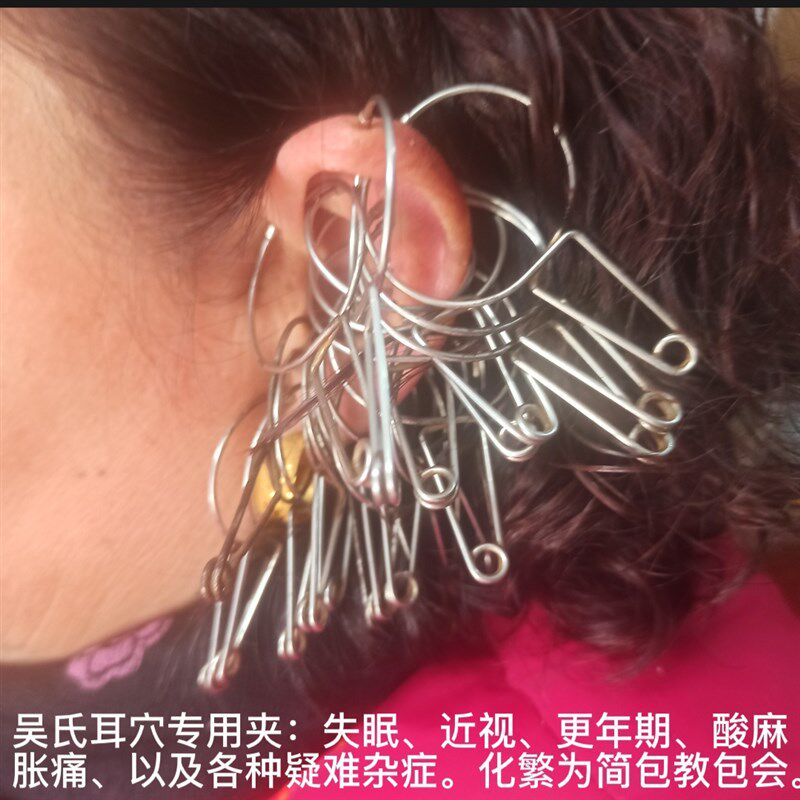 【32只装】穴位夹 全息夹 耳穴夹 耳贴 按摩 耳针吴氏耳夹保健夹