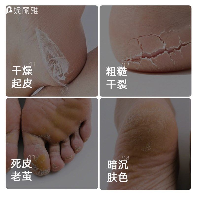 凝胶足膜袜去死皮角质老茧硅胶脚膜防干裂足膜套脚后跟保湿护理