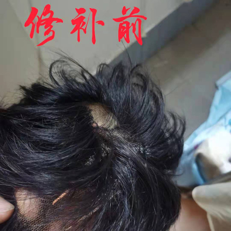 假发片男短发 全真人发 头顶补发片 修补染色修剪