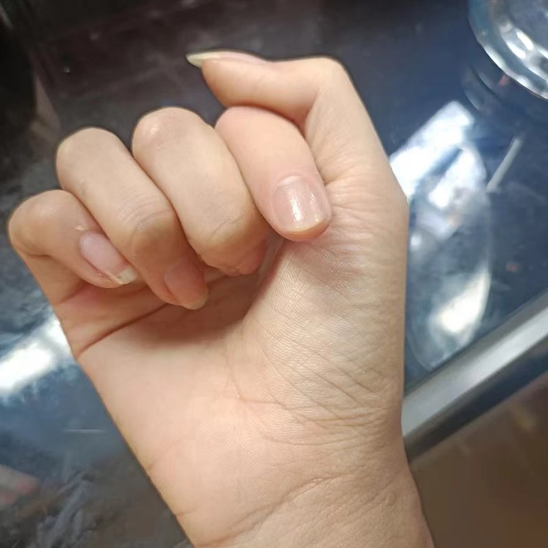 康捷思定制假肢手指 硅胶断指残肢护套适用美容假脚趾头