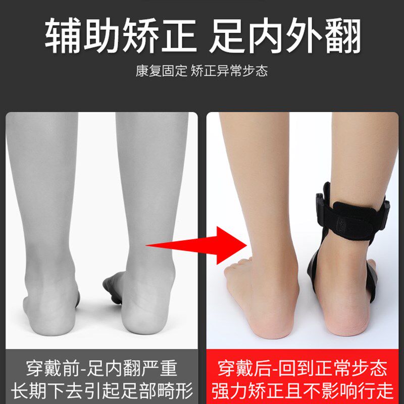 足内翻矫正器康覆训练器材脚踝足托 托穿鞋扁平足外翻足下垂固定