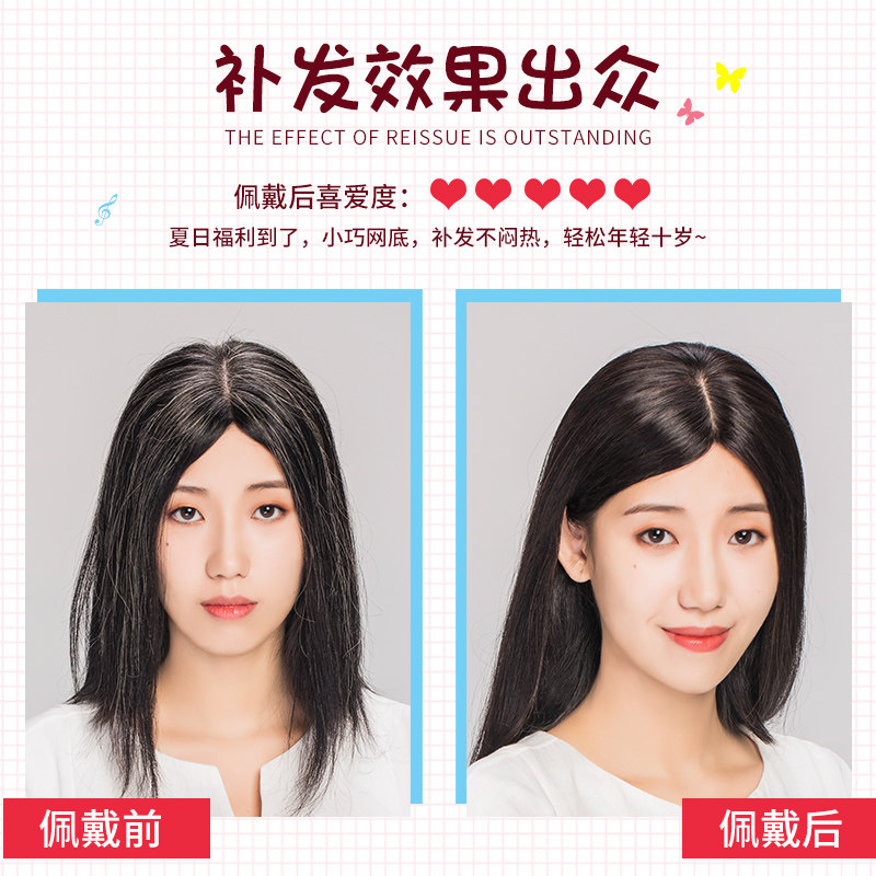 假发片小一片式女无痕真人发丝发际线假发贴前额迷你补发头顶蓬松