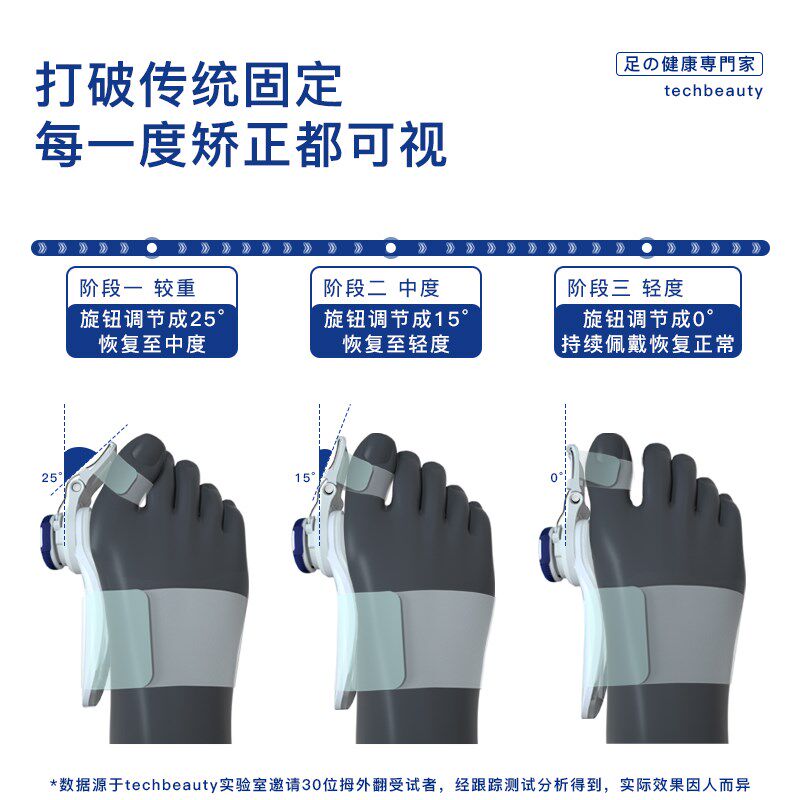 科靓脚趾矫正器拇指外翻分趾器可调节脚骨纠正儿童大母足指头男女