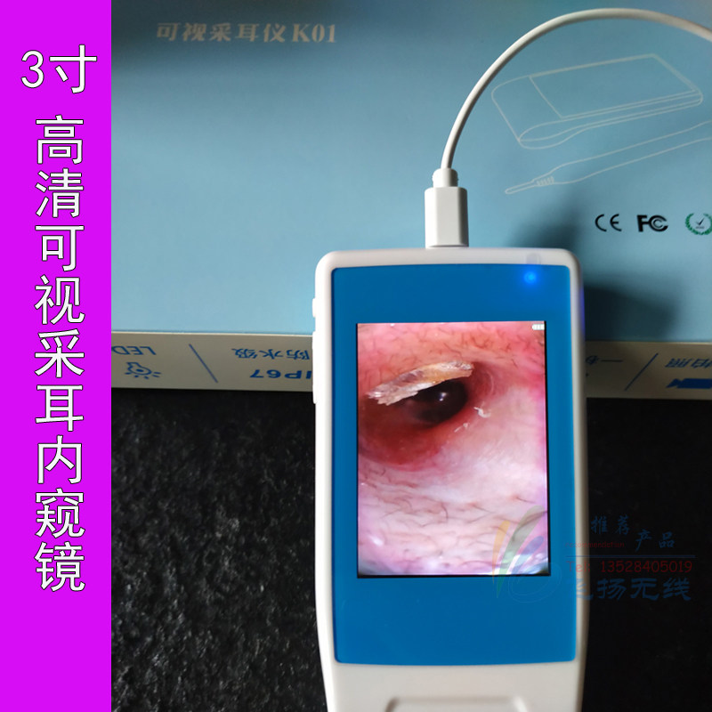 3寸高清可视耳镜 采耳内窥镜 发光掏耳挖耳工具 耳道鼻腔检查仪