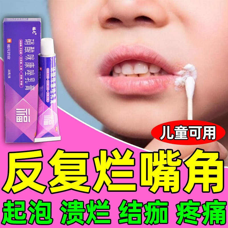 口角炎嘴角烂药膏嘴巴上火起水泡唇炎嘴开裂脱皮疱疹专用儿童成人