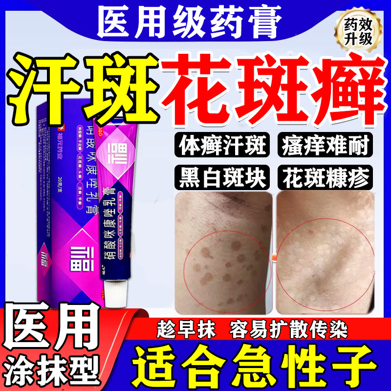 汗斑花斑癣专用特药效膏快消速白斑褐斑马色拉菌真菌感染花斑糠疹