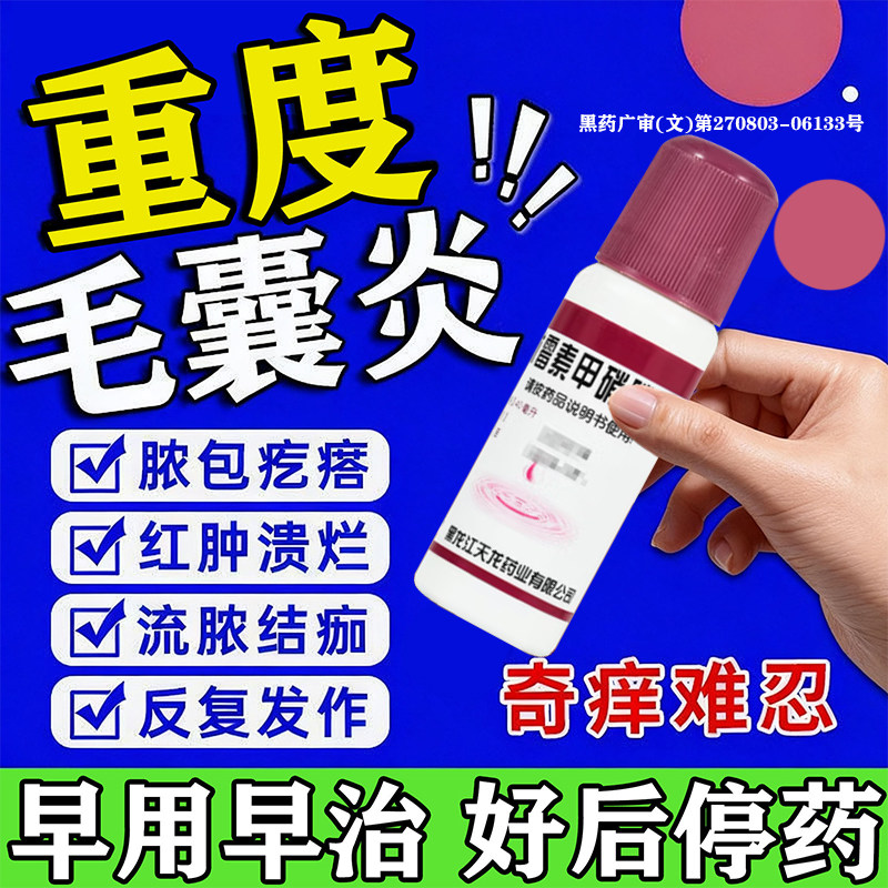 克林霉素甲硝唑搽剂磷酸酯溶液外用治疗毛囊炎专用药膏头皮头部专