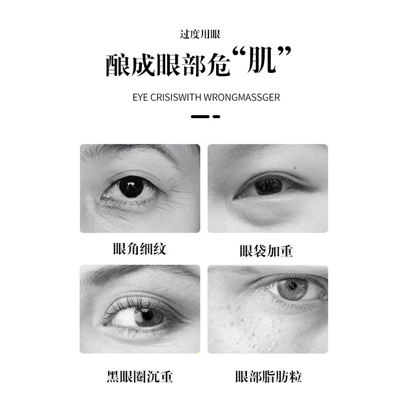 眼部按摩仪淡化细纹黑眼圈眼袋缓解疲劳微电流美眼护眼仪器眼保仪