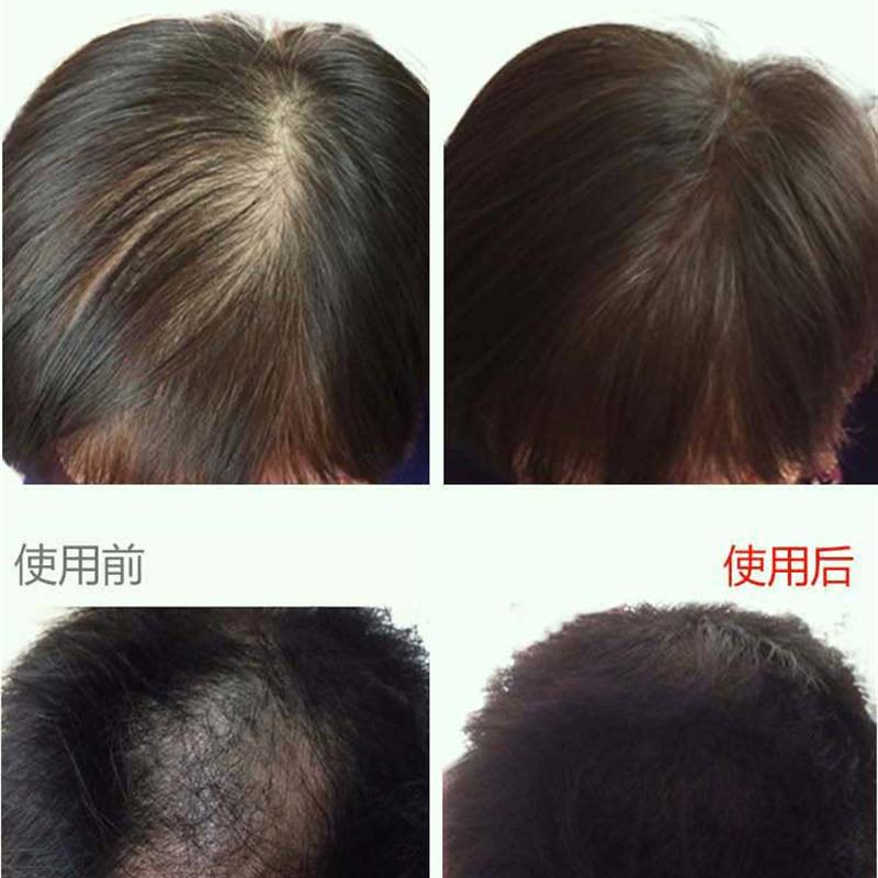 增发纤维头发纤维粉美发假发男女浓密发粉补发顶遮盖丰稀疏