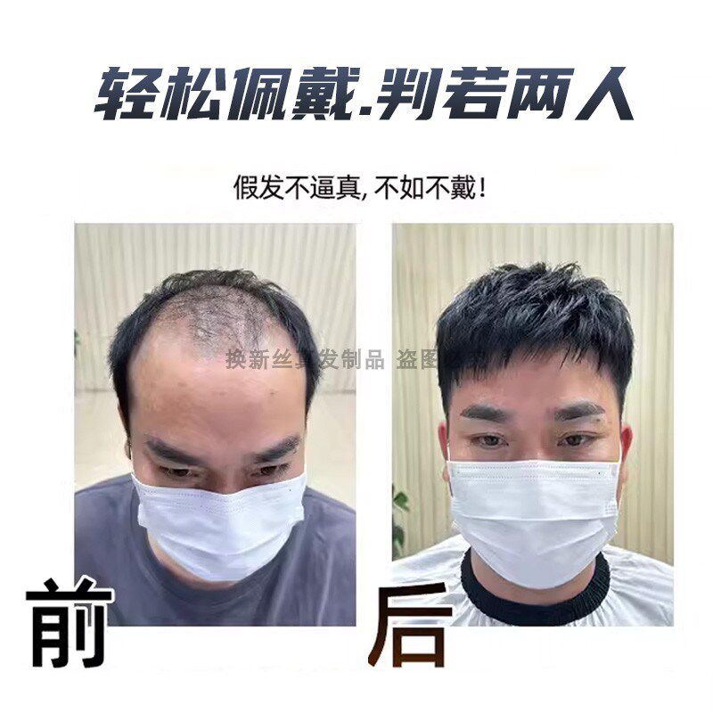 双递针假发男头顶真发高档中老年短直发光头专用全头套隐形补发片
