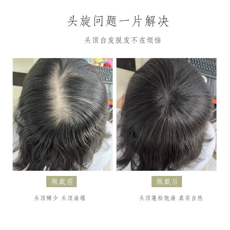 真人发丝补发片短发适用遮盖白发 假发片瑞士网全手织遮盖头顶稀