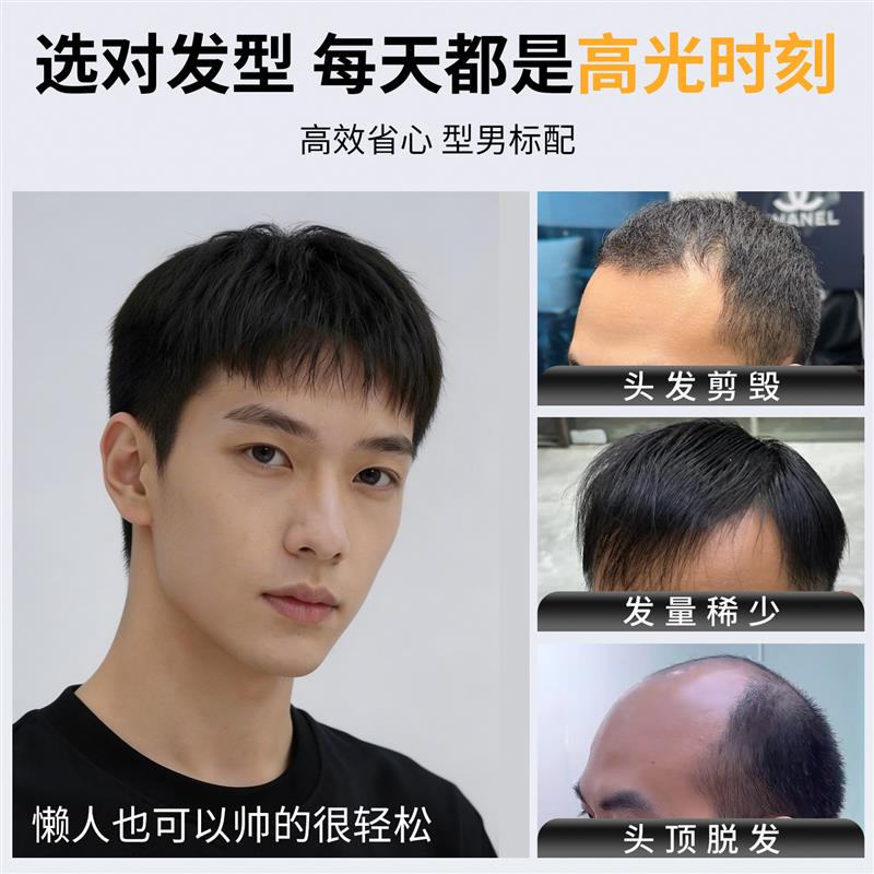 男士假发短发夏季清爽短毛寸自然时尚假发男款真发日常头顶补发块