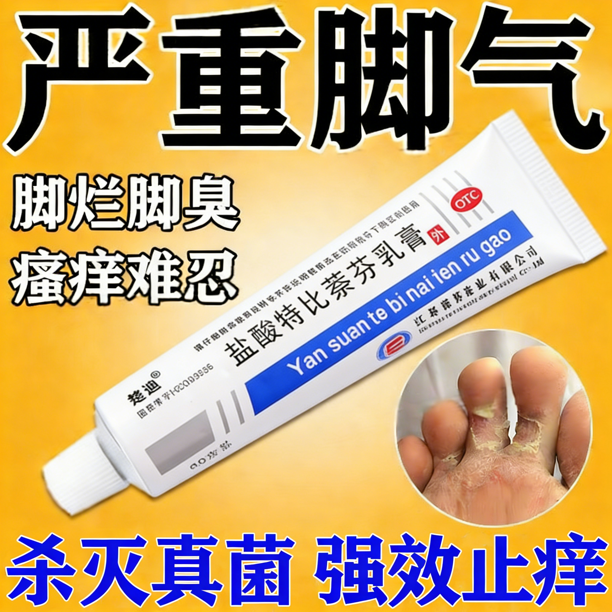 盐酸特比萘芬乳膏正品脚气止痒脱皮杀菌真菌感染专用特药膏效软膏
