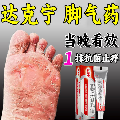 达克宁治脚气的官方旗舰店达克宁除脚气止痒脱皮杀菌真菌感染专用