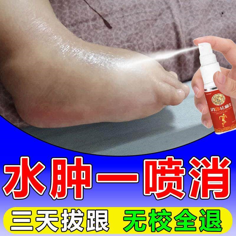 脚肿消肿的药专用治疗老人去下肢小腿部水肿浮肿利尿排水特效神器