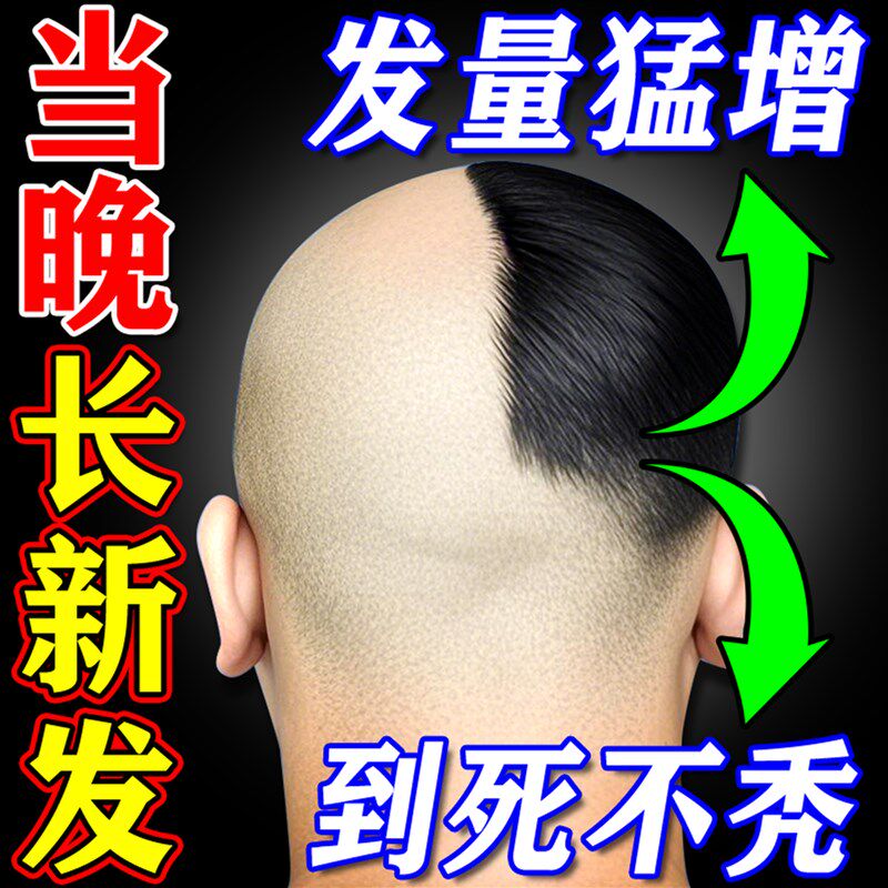 生发剂快速生长增发洗发水防脱神器男女专用剂激活毛囊育长精华液