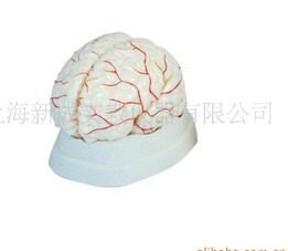 脑动脉模型308