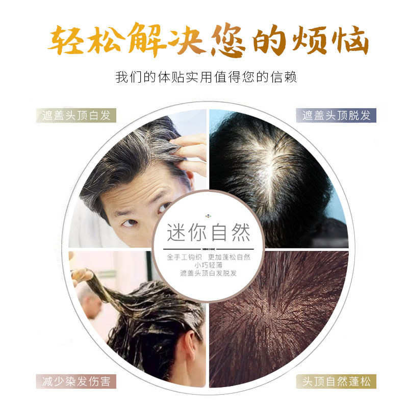 头顶头发稀少遮白发假发片女真发递针头顶补发贴片一片式无痕隐形