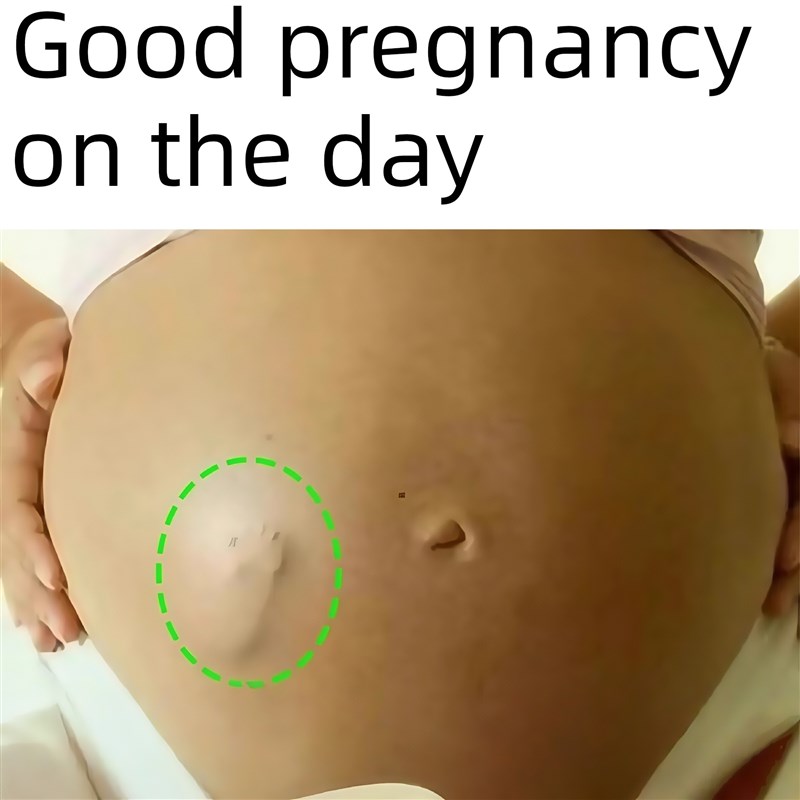 备孕贴女提高卵子质量促孕调理助孕神器促排卵助孕卵巢堵塞双胞胎