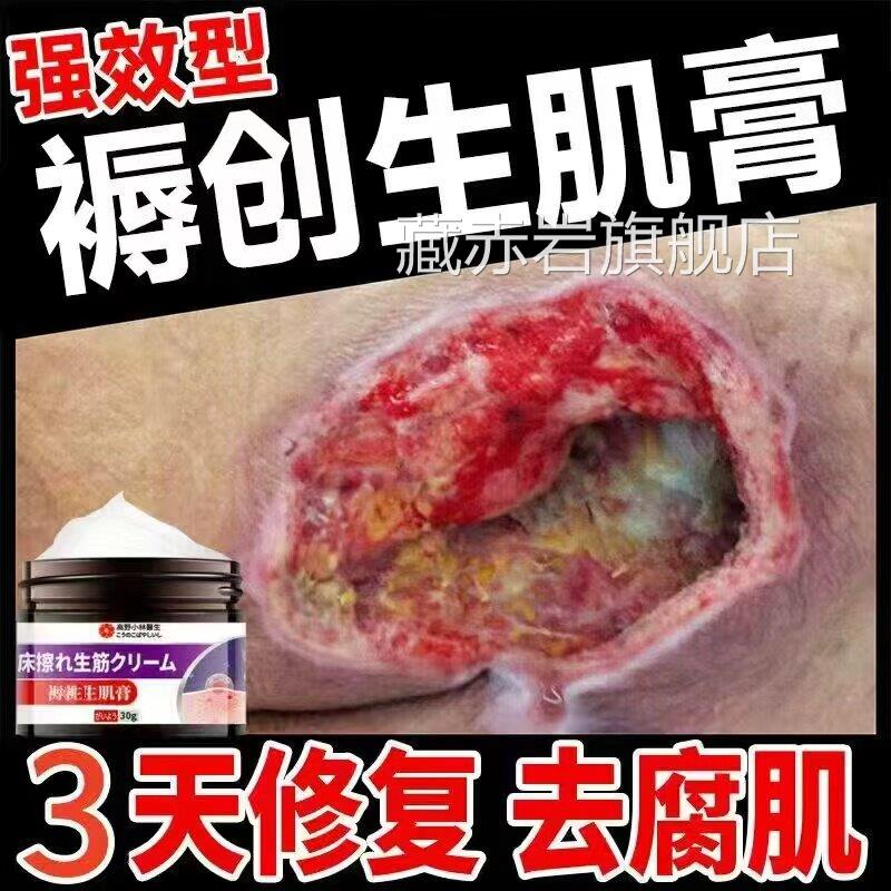 日本去生肌腐膏伤口愈合促进长肉膏专用卧床老人臀部屁屁外用空洞