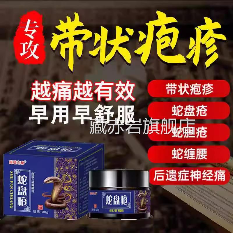 带状疱疹病毒膏蛇盘胆疮后遗症神经疼药蛇疮克星蛇缠腰外用藏赤岩