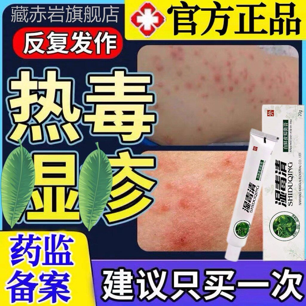 热毒湿止疹痒膏皮肤一热就痒瘙痒专用湿除红斑皮炎疹红肿感染喷LL