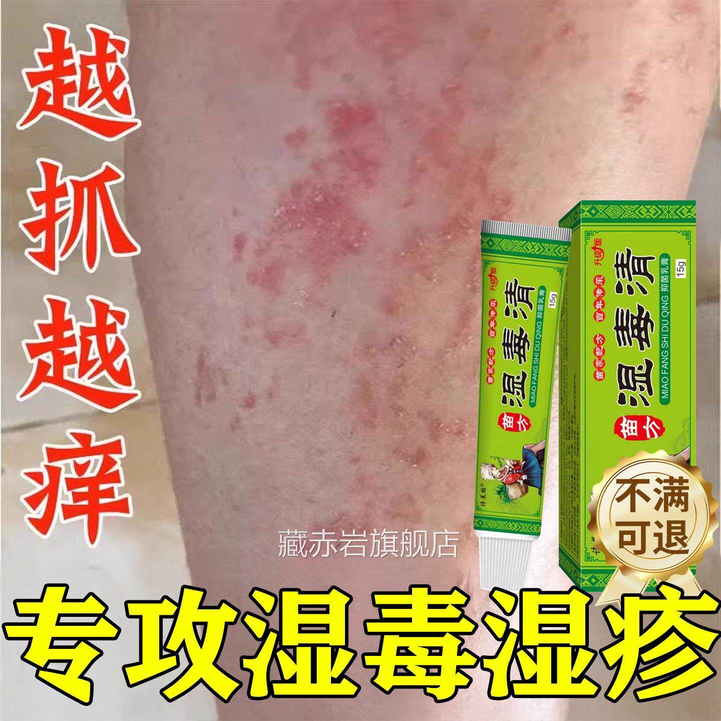 湿毒软膏清湿祛根湿痒热止痒皮肤皮炎瘙痒水泡治除湿专用膏藏赤岩