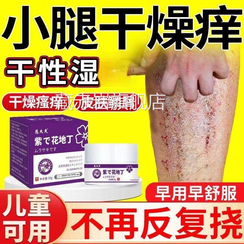 皮肤干燥瘙痒止痒膏抑菌膏补水湿冬天保小腿痒干性湿痒颜慈安旗舰