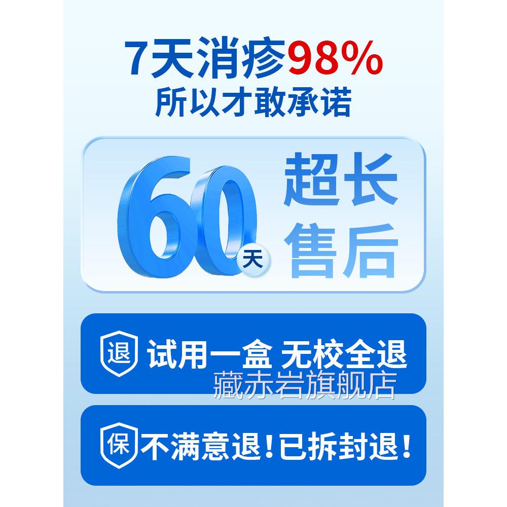 皮肤湿止痒疹去特效皮肤瘙痒外用喷雾剂治疗止痒专用去顽固皮炎颜