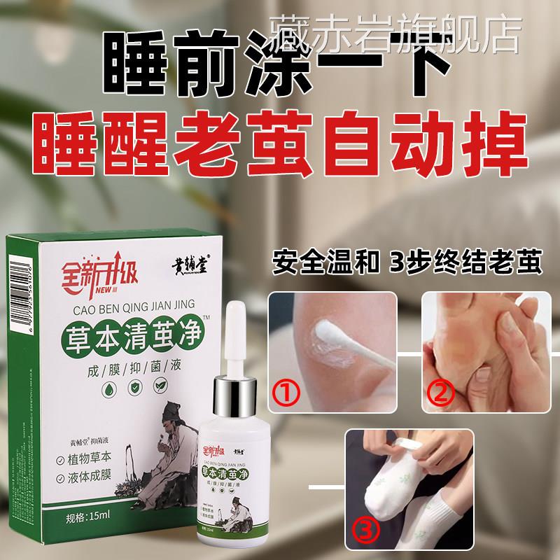老茧去除软化剂手茧垫关节茧脚茧脚掌脚后跟去厚硬皮茧鸡膏眼神器