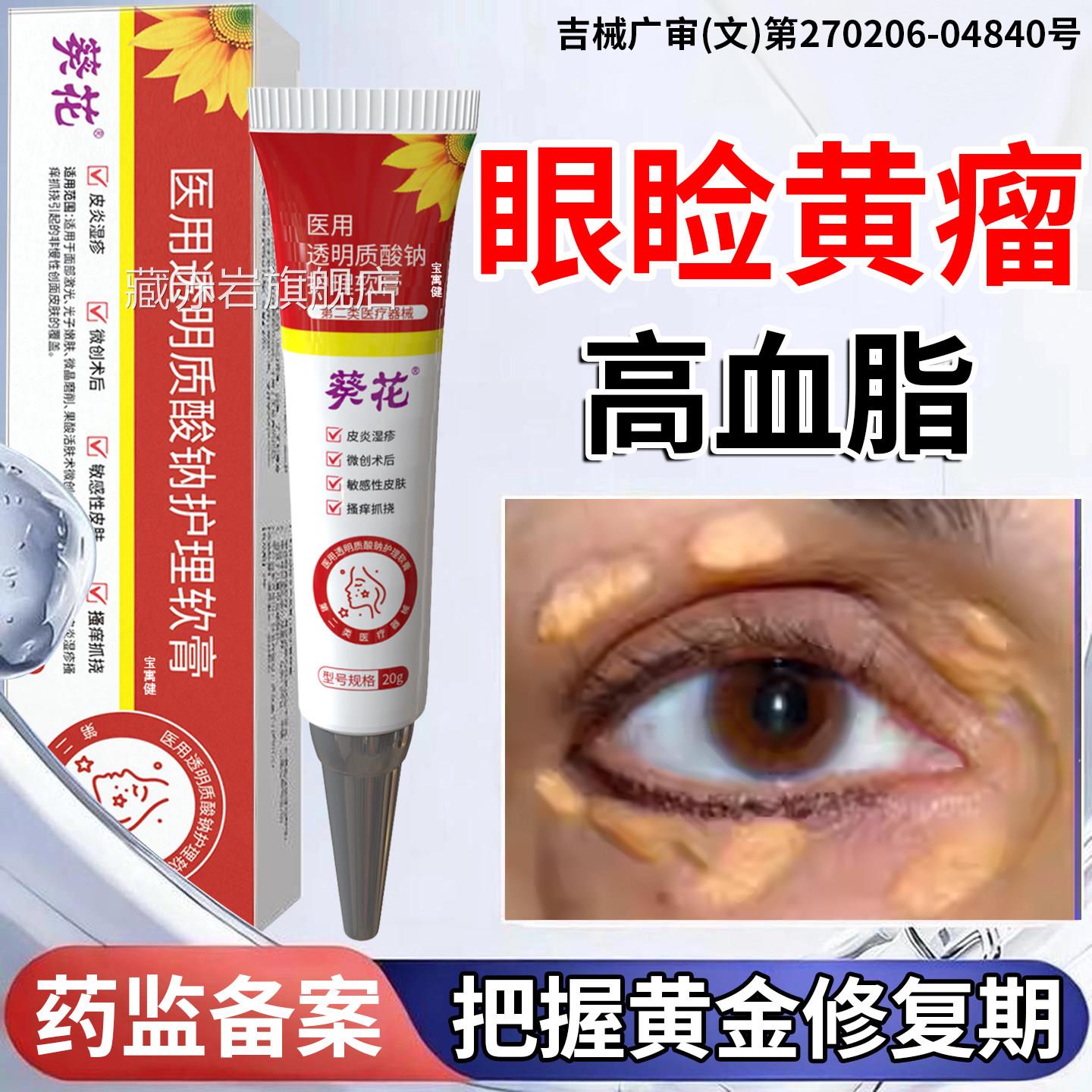 睑黄瘤去除神器眼睑黄瘤疣去眼黄斑瘤疣专用膏血脂皮高眼部脂肪粒