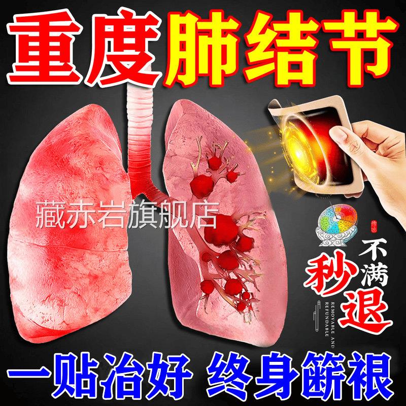 肺结节效特药槲皮素清肺散结节璃丸肺结节消除的药磨玻去小结节贴