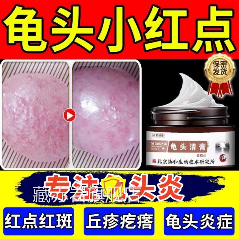 官方正品男性龟起头上有小红点瘙疙瘩痒真菌感染霉菌性龟头炎症膏