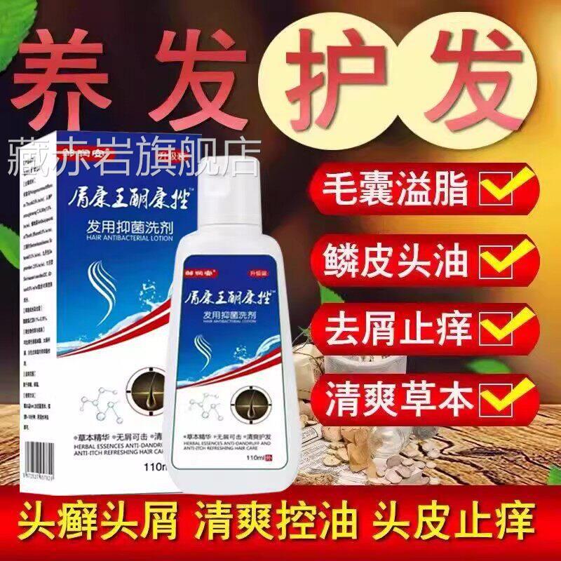 屑康酮康挫洗剂王去屑止痒洗发水防掉发滋养发根去头皮屑控油清爽