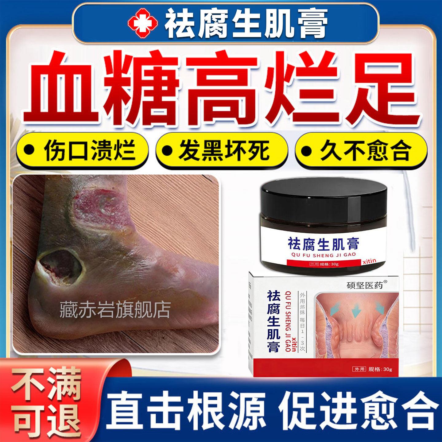 糖尿病烂足专用膏口愈合祛腐生肌促进伤伤口长肉溃疡感染膏药贴GX