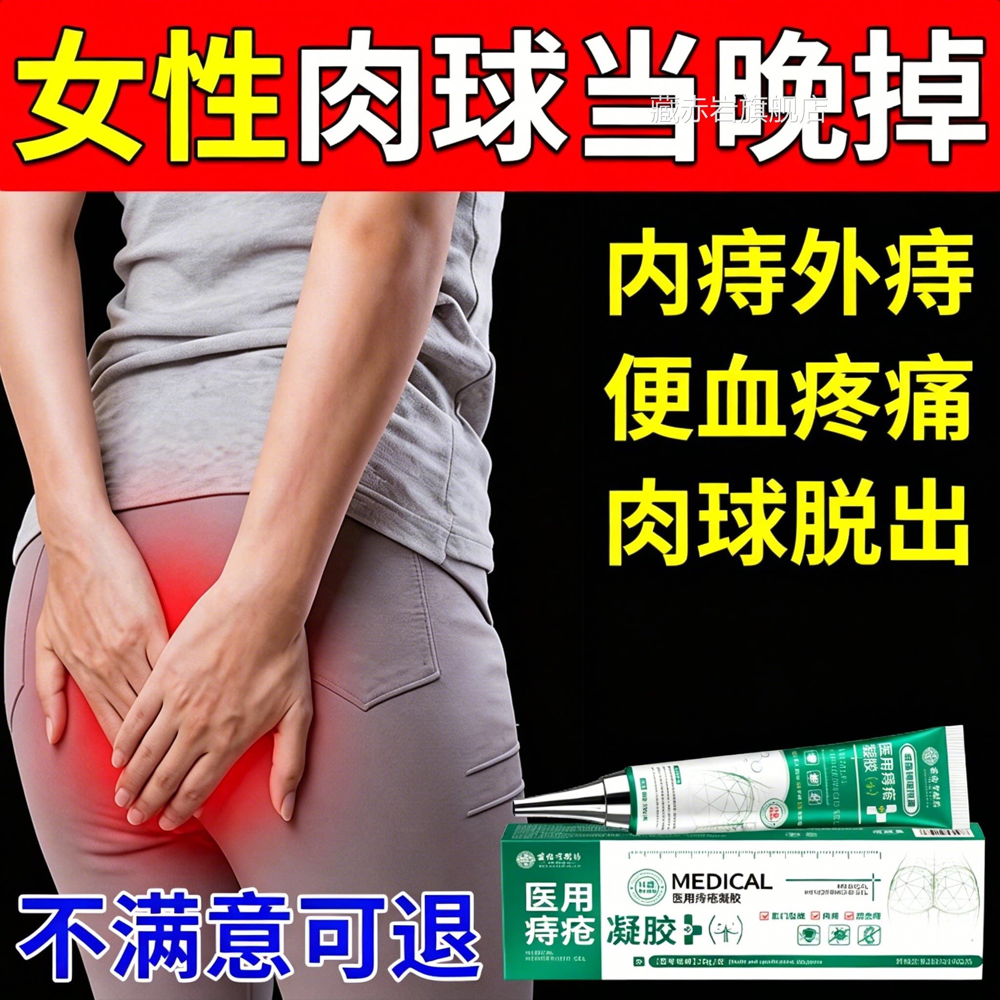 痔疮膏消肉球痔根非断正 品消痔凝胶痣舒痔枯 散男女性官方旗舰店