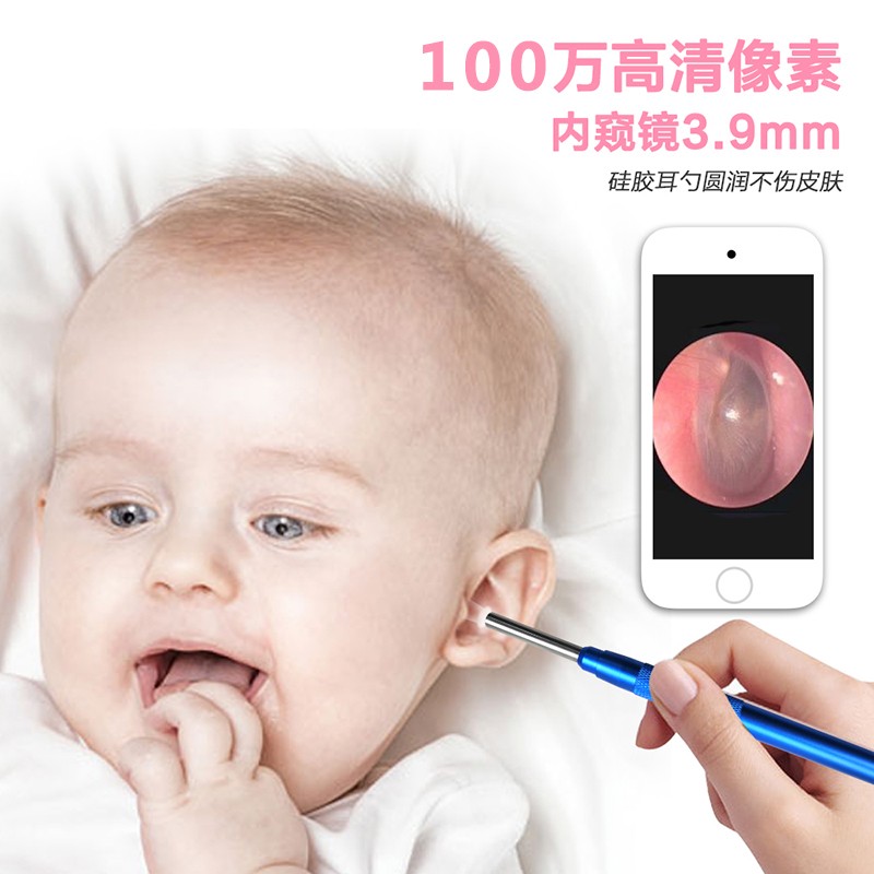 儿童宝宝内窥镜可视挖耳勺发光掏耳神器耳朵智能超清采耳工具套装