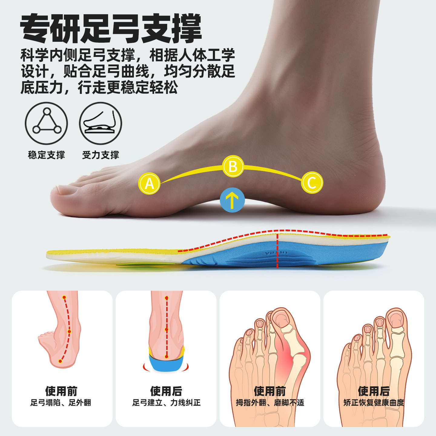 迪力捷 塑形直腿鞋垫预防拇外翻XO型腿扁平足足弓支撑碳板男女款