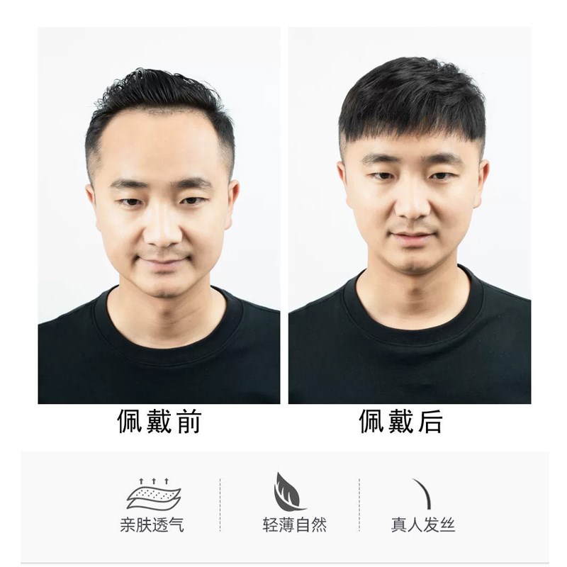 男士刘海生物头皮假发片前额隐形无痕发际线真发超薄补发片增发量