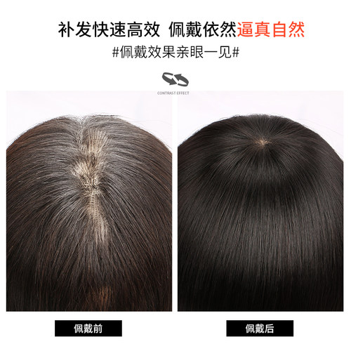 真人发丝假发片无痕遮白发自然黑短发递针顶心补发片蓬松一片式