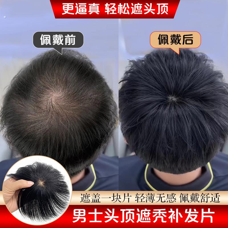 假发片男全真发头顶头旋发缝疤痕补发片递针旋遮斑秃脱发男士假发