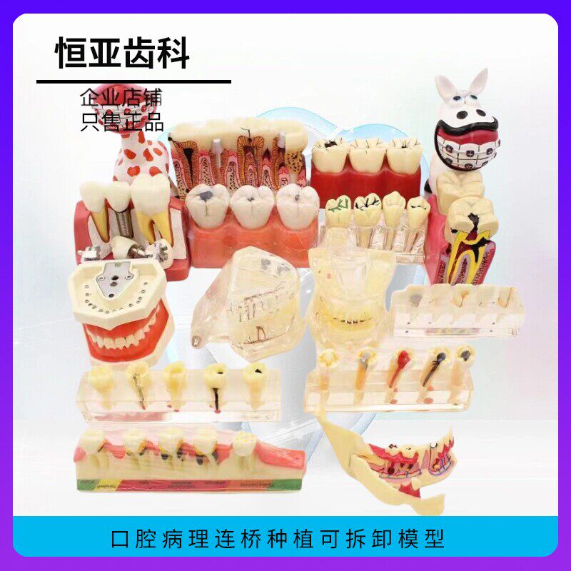 牙齿模型口腔教学正畸种