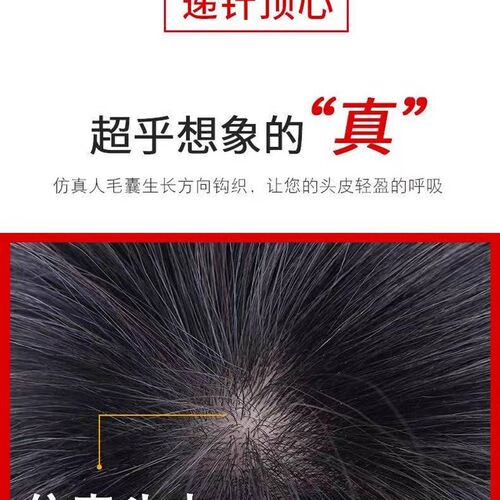 遮白发假发片真发头顶补发片女无痕增加发量蓬松短发羊毛卷隐形