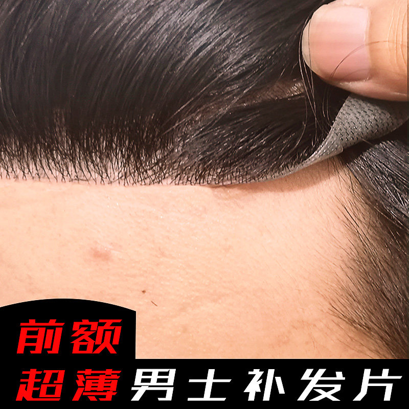 男士前额发际线假发贴假刘海前额m型刘海生物头皮补发片隐形无痕