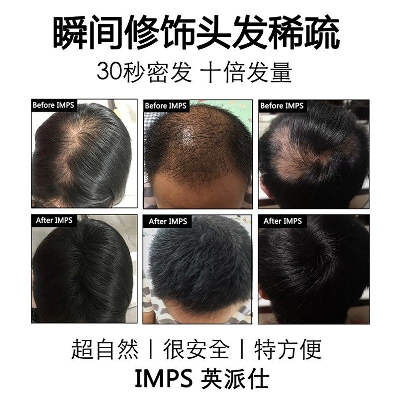 头发纤维粉增发密发补发神器假发粉发际线填充浓密增多遮盖稀少