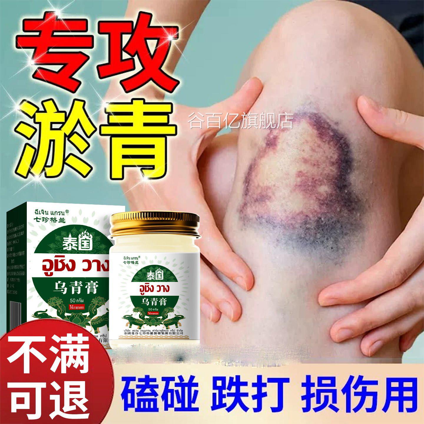 去淤青膏乌青快消除跌打损伤撞伤扭伤消肿散淤血速舒缓发紫酸痛膏