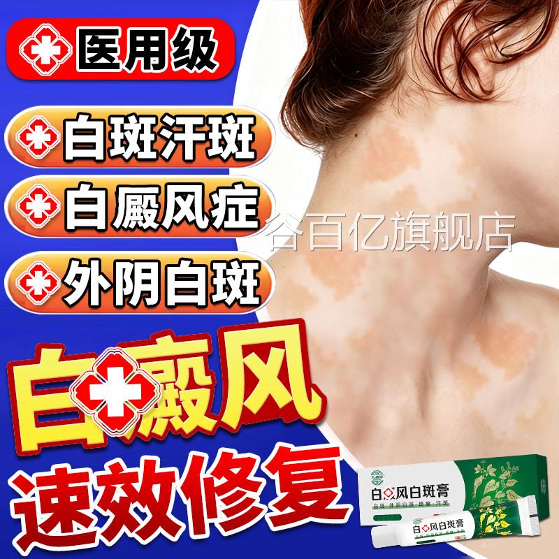 皮肤白斑白癜1风外用黑色素生长汗斑1花斑1癣专用1药膏快速白消斑