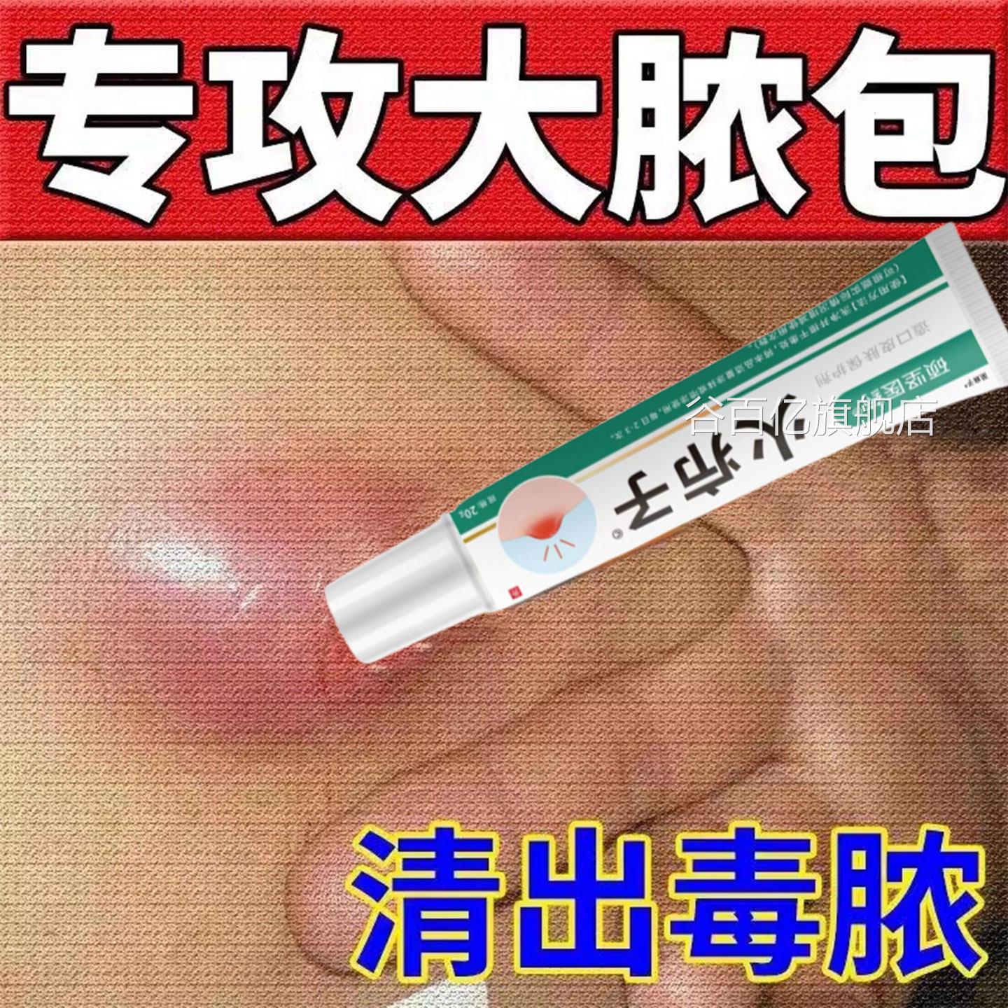 火疖子乳膏旗舰店屁股坐板疖肿拔毒脓止痒皮脂腺皮肤抑拔外用软膏